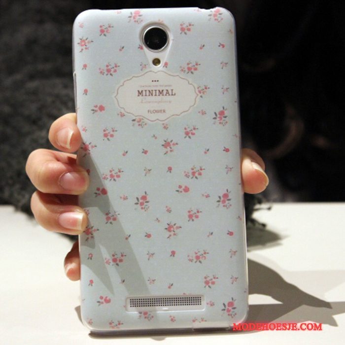 Hoesje Mi Note 2 Zacht Mini Roze, Hoes Mi Note 2 Zakken Trend Mooie